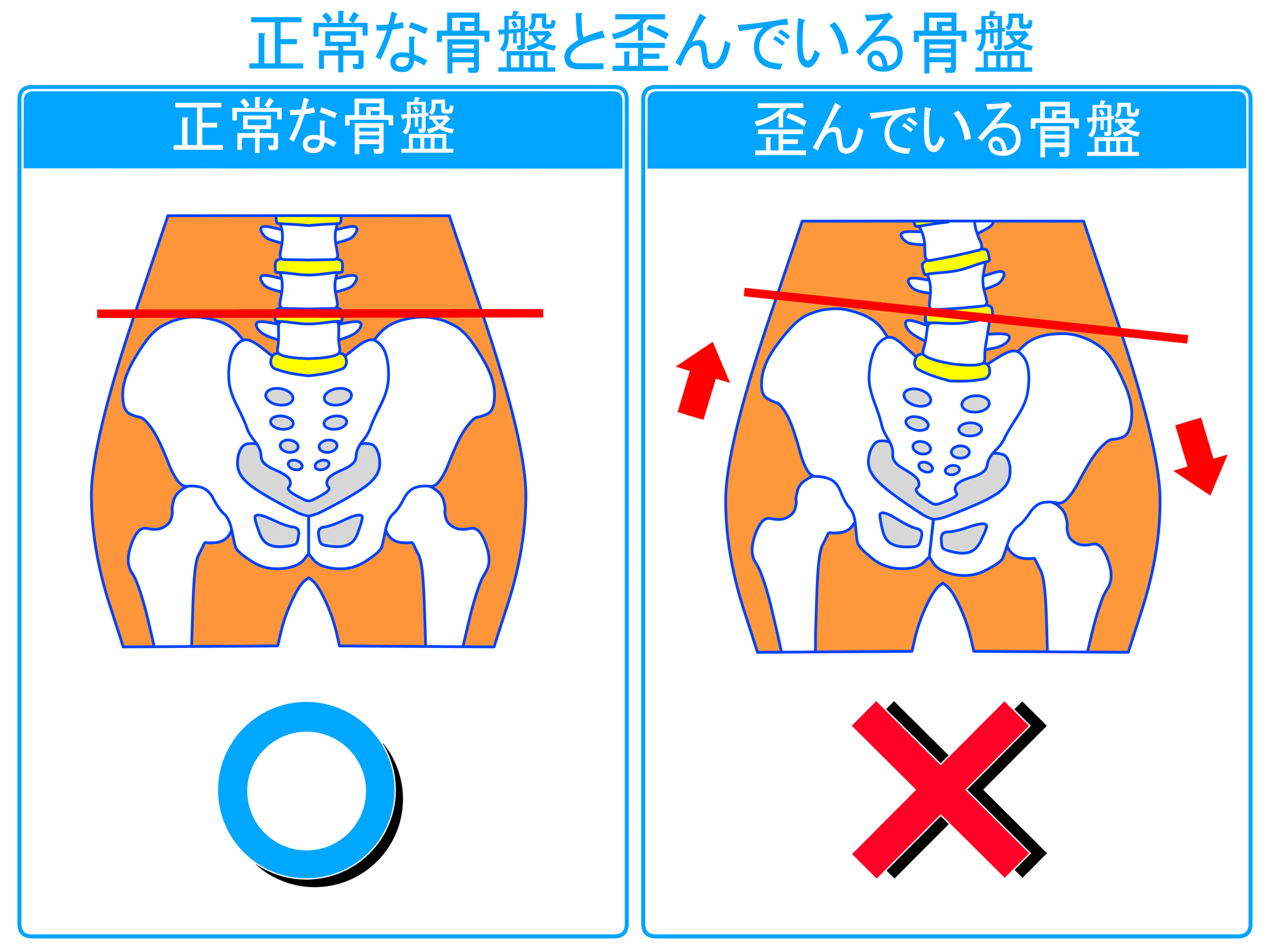 産後 の 骨盤 矯正