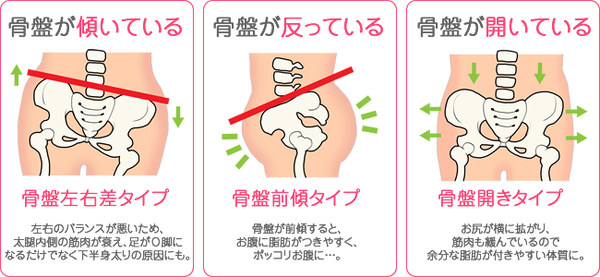 産後骨盤矯正